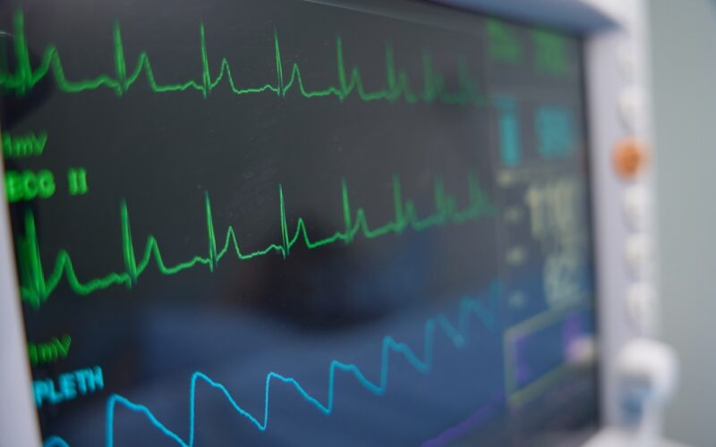 Close-up photo of a patient monitor with heart rate readings